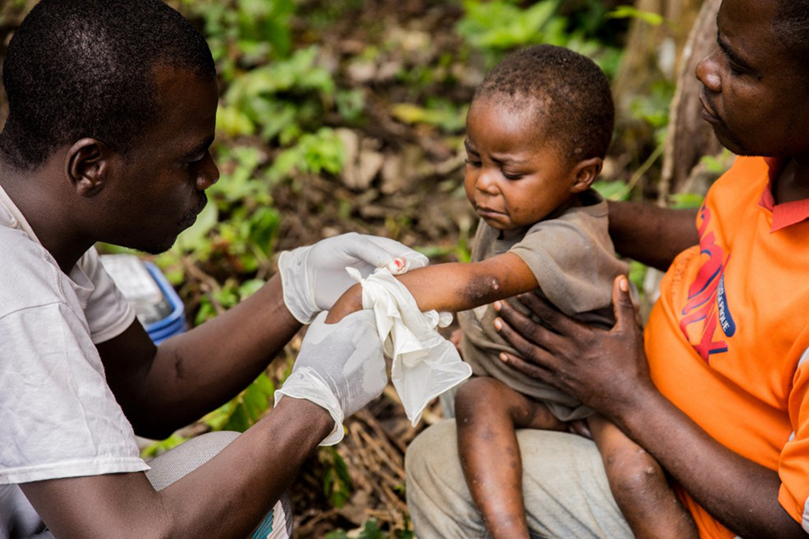 A child affected by monkeypox, sits on his father's legs while receiving treatment at the centre of the International medical NGO Doctors Without Borders (Medecins sans frontieres - MSF), in Zomea Kaka, in the Lobaya region, in the Central African Republic on October 18, 2018. (Credits: CHARLES BOUESSEL / AFP)